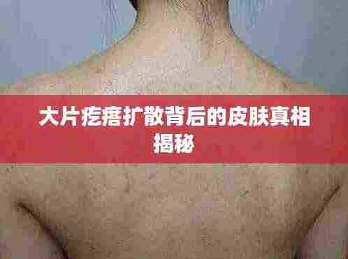 大片疙瘩扩散背后的皮肤真相揭秘