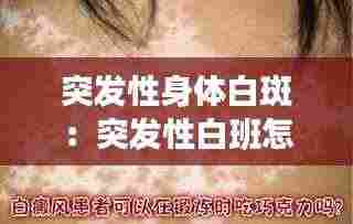 突发性身体白斑:突发性白班怎么治疗