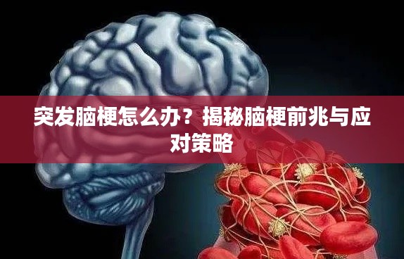 突发脑梗怎么办?揭秘脑梗前兆与应对策略